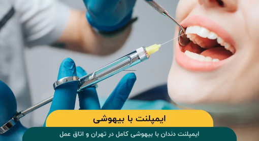 ایمپلنت-با-بیهوشی